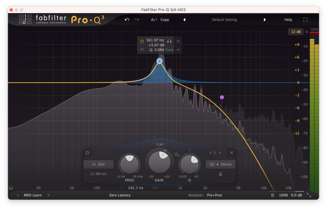 Hearing-Loss-EQ